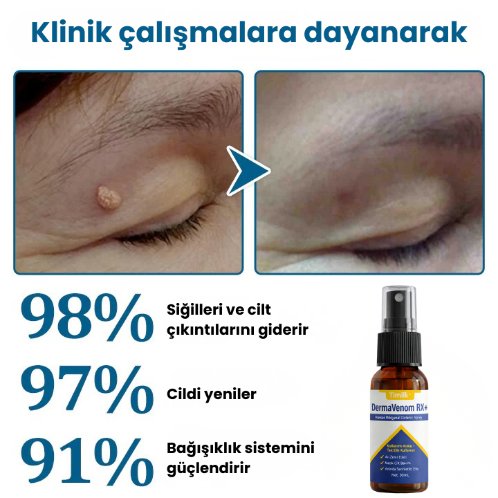 Timilk® DermaVenom RX+ Hassas Bölgesel Giderici Sprey