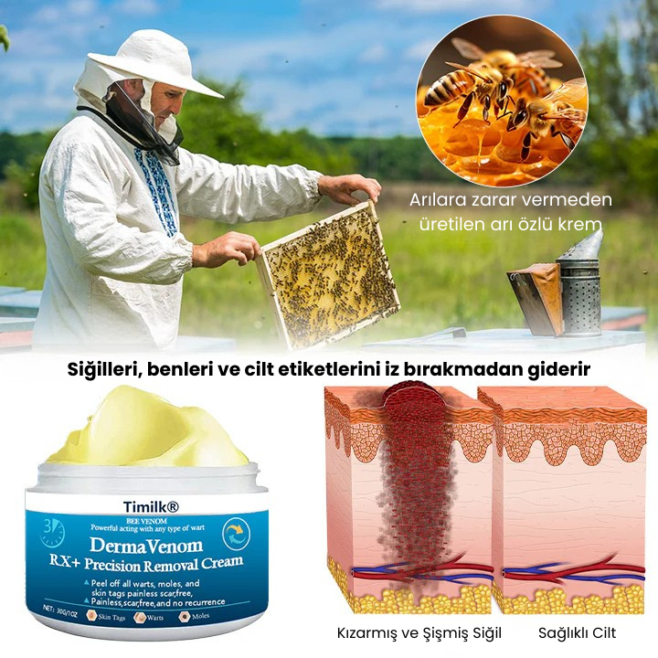 Timilk® DermaVenom RX+ Siğil, Et Beni ve Cilt Çıkıntısı Giderici Krem
