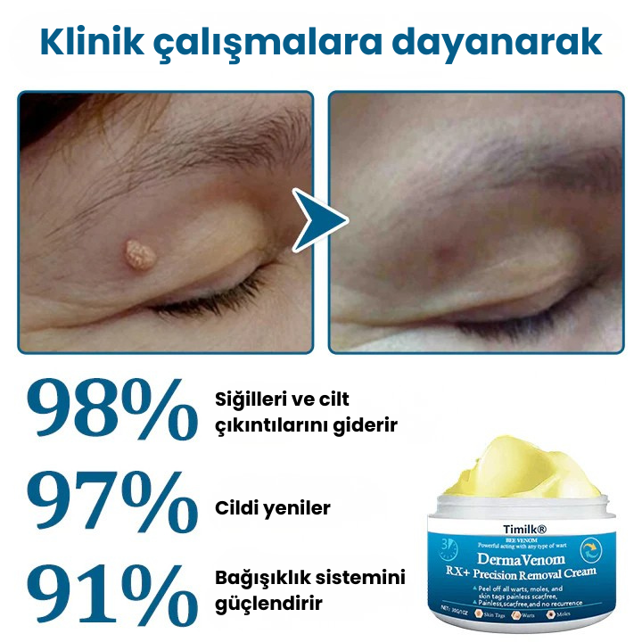 Timilk® DermaVenom RX+ Siğil, Et Beni ve Cilt Çıkıntısı Giderici Krem