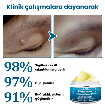 Timilk® DermaVenom RX+ Siğil, Et Beni ve Cilt Çıkıntısı Giderici Krem