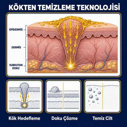 Timilk® DermaVenom RX+ - Siğil ve Et Beni Yağı